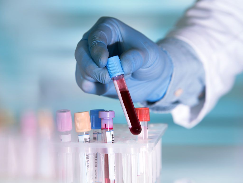 Un hombre que lleva una máscara y guantes está trabajando en un laboratorio.