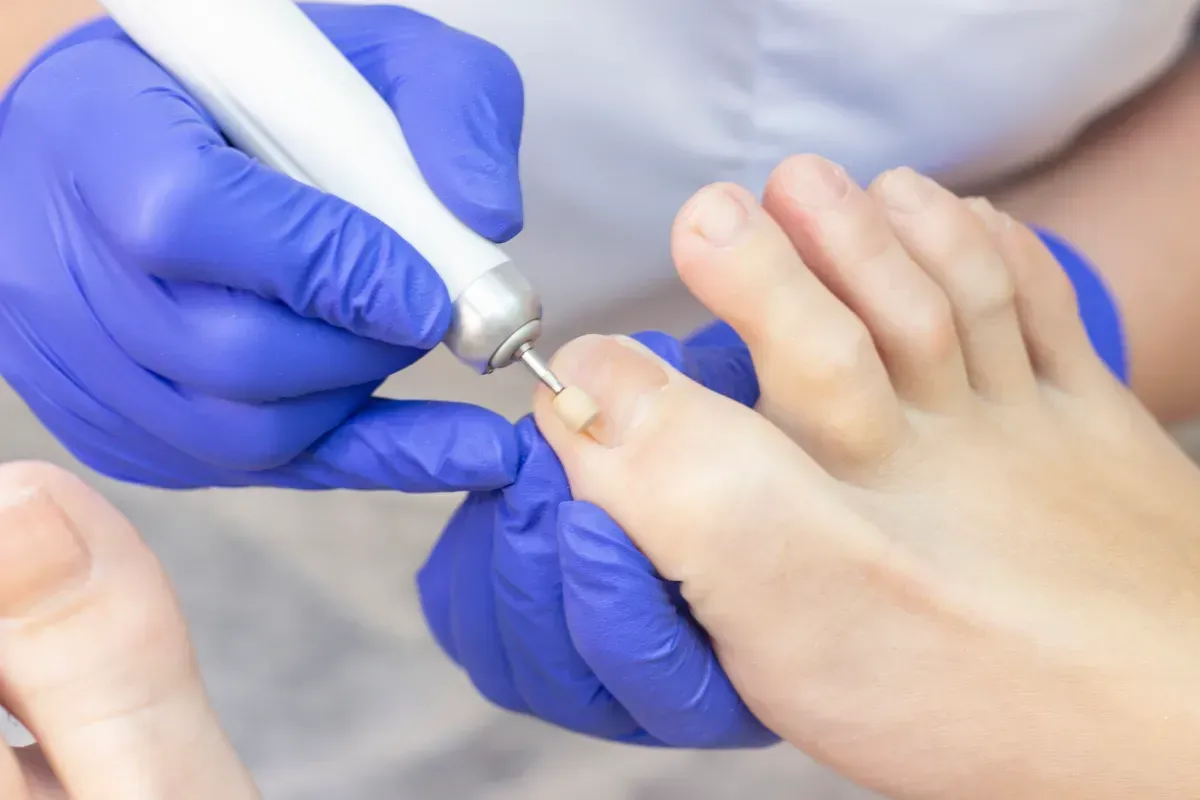 Una persona se está haciendo un arreglo de uñas de los pies con un podólogo.