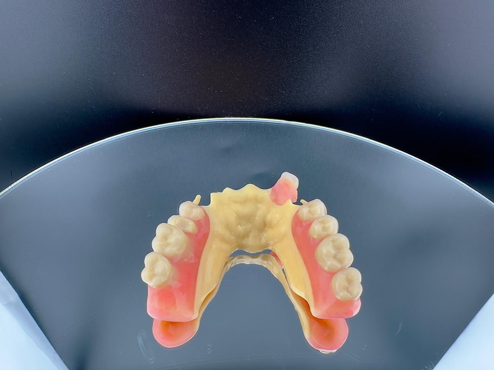 Un puente de implantes dentales 