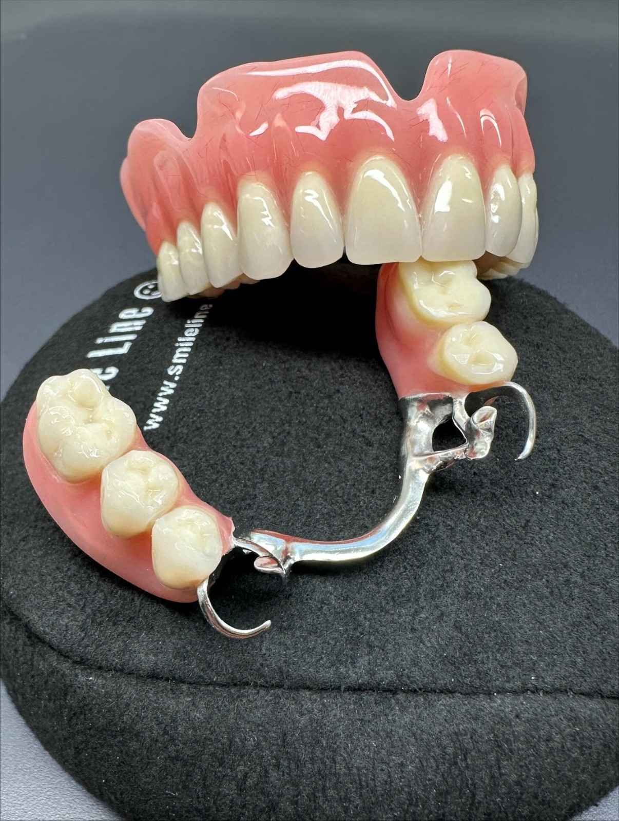 Un puente de implantes dentales 