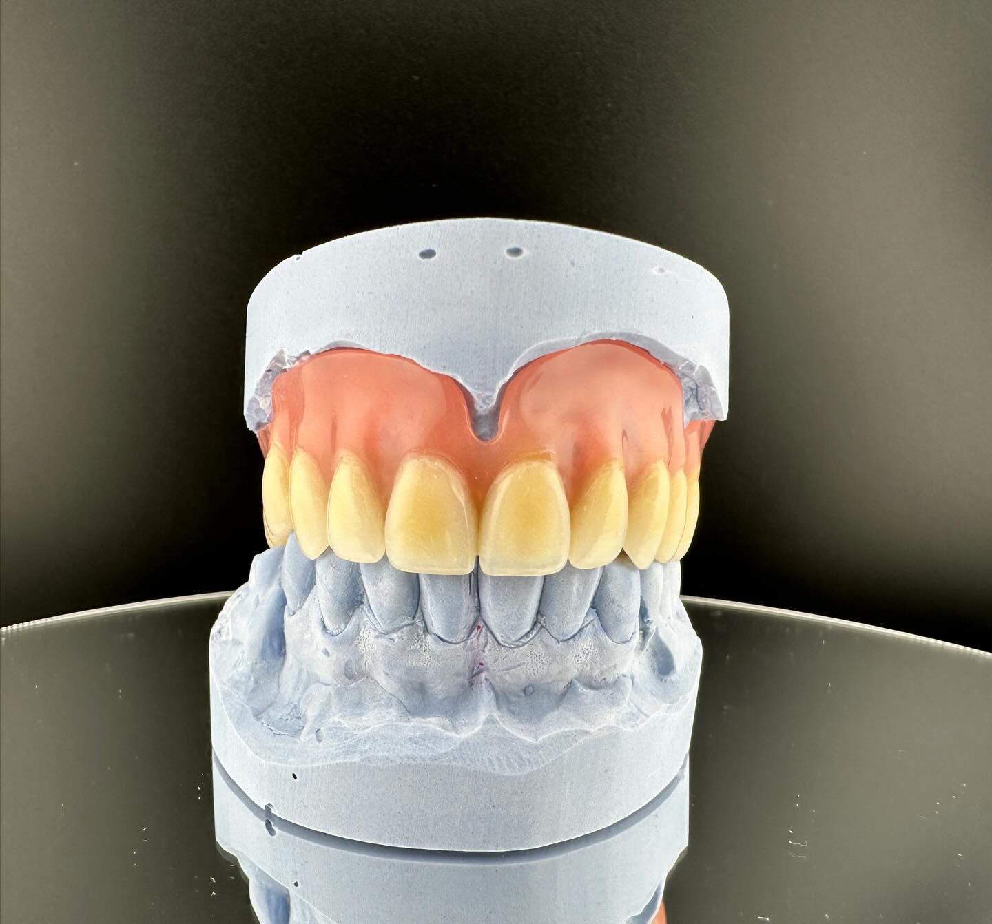 Modelo dental que muestra una prótesis dental superior completa 