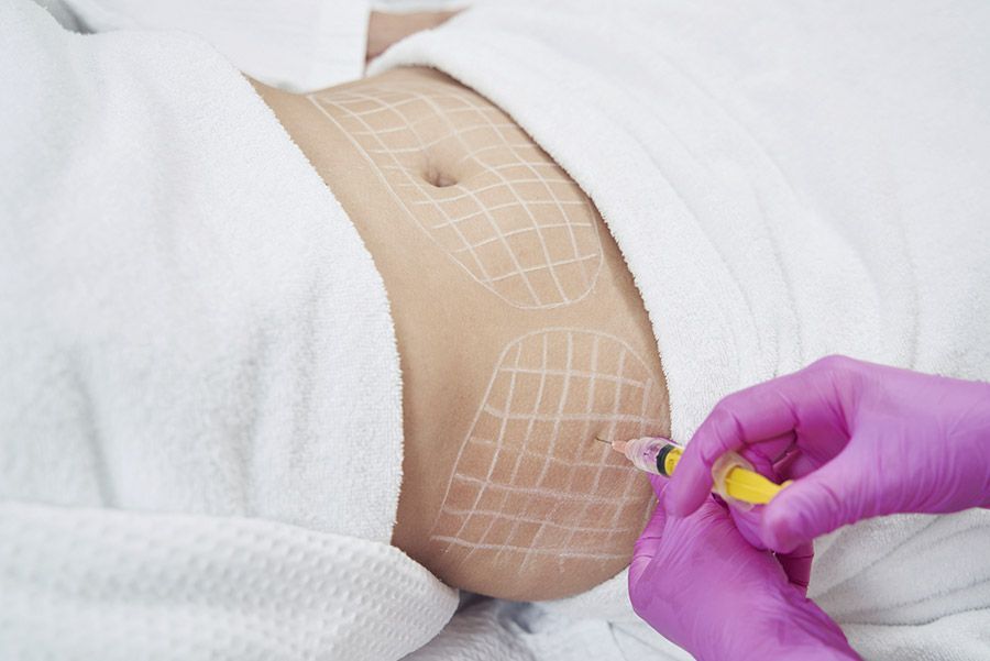 Persona que recibe inyecciones abdominales con la piel marcada. Manos enguantadas de color rosa. Bata blanca.