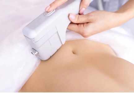 Persona recibiendo tratamiento corporal en una camilla de masaje. Se utiliza un dispositivo manual sobre el abdomen.