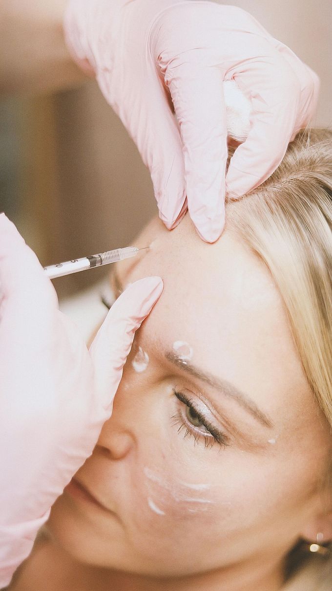 Persona recibiendo una inyección facial en la frente. Manos enguantadas de color rosa sostienen una jeringa.