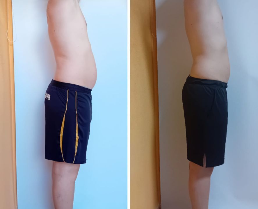 Una foto de antes y después del estómago de un hombre.