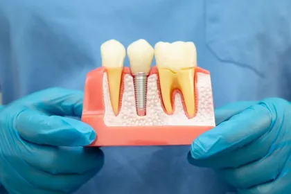 Un profesional con guantes utiliza un instrumento dental para ajustar una prótesis dental en un modelo dental.