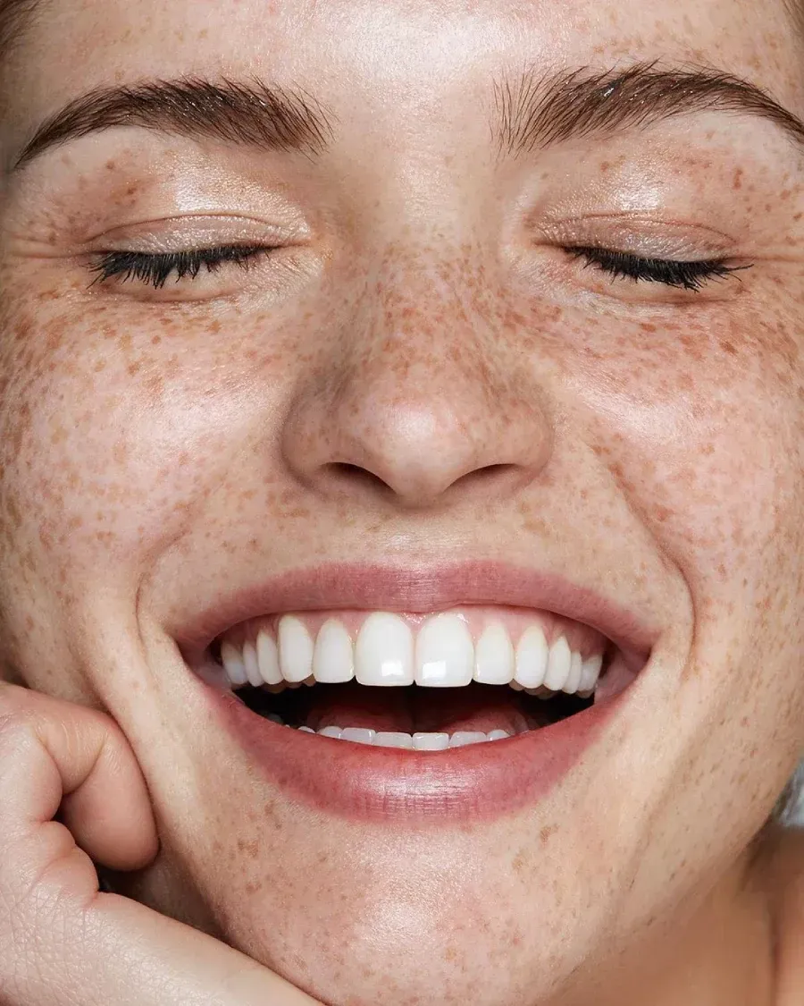 Primer plano de una persona sonriente con pecas en la cara y la mano apoyada cerca de la barbilla, con los ojos cerrados.
