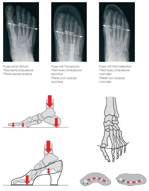 Fuss-Orthesen - Orthopädie Schärer AG in Luzern