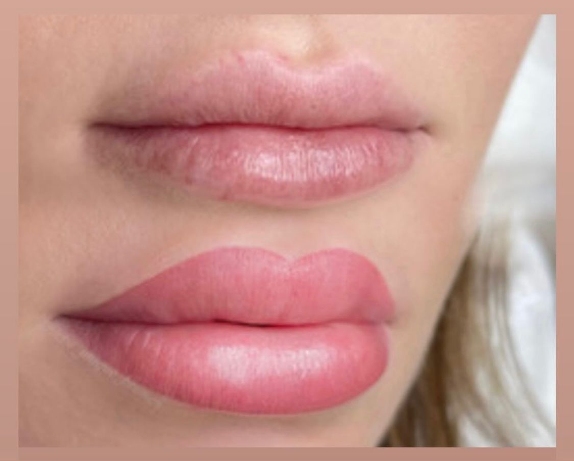 Lippen vorher nachher