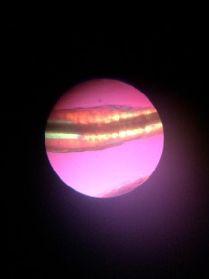 Haarwurzel unter einem Mikroskop 2