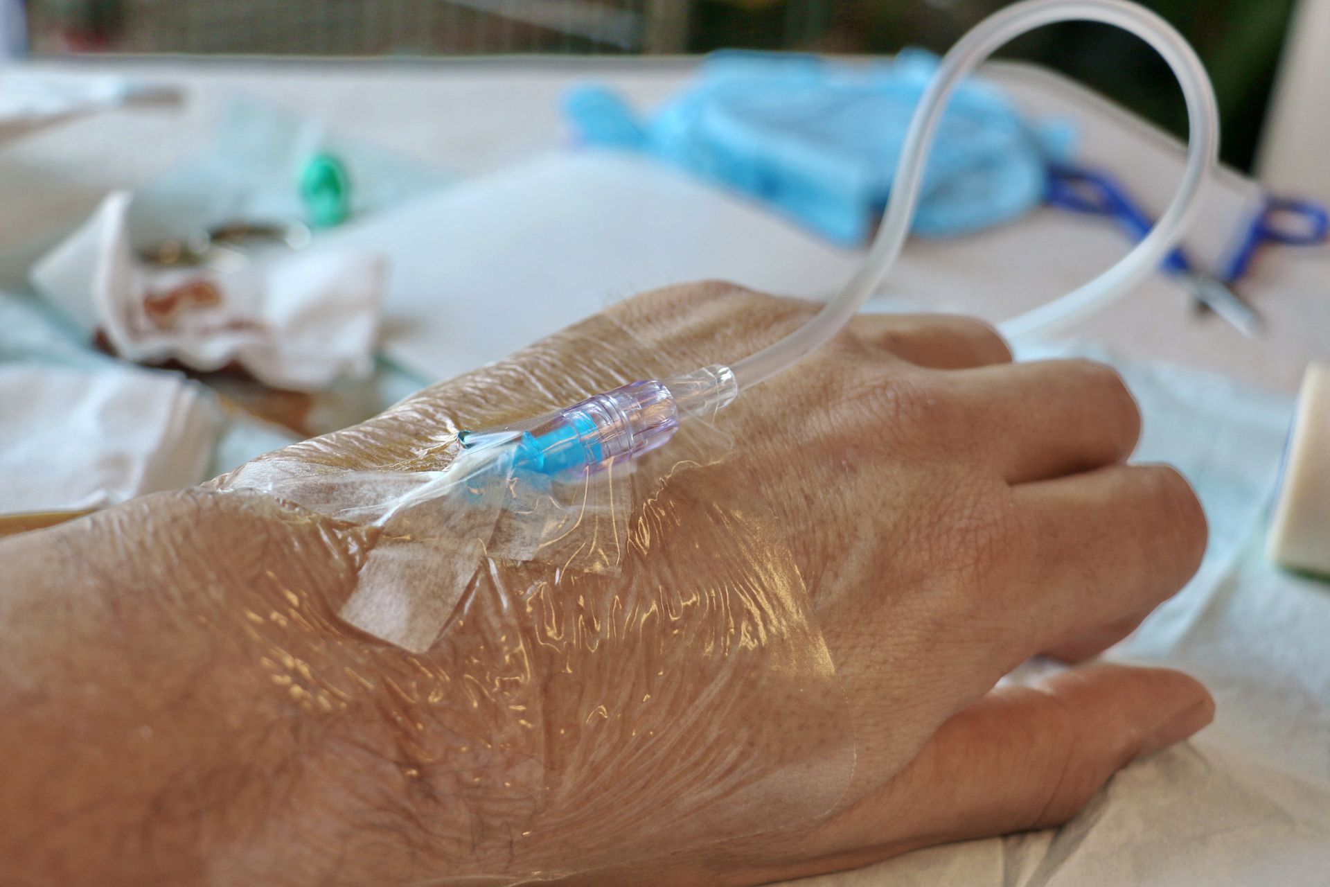 Gros plan d'une main avec un cathéter intraveineux transparent fixé par du ruban adhésif dans un environnement hospitalier