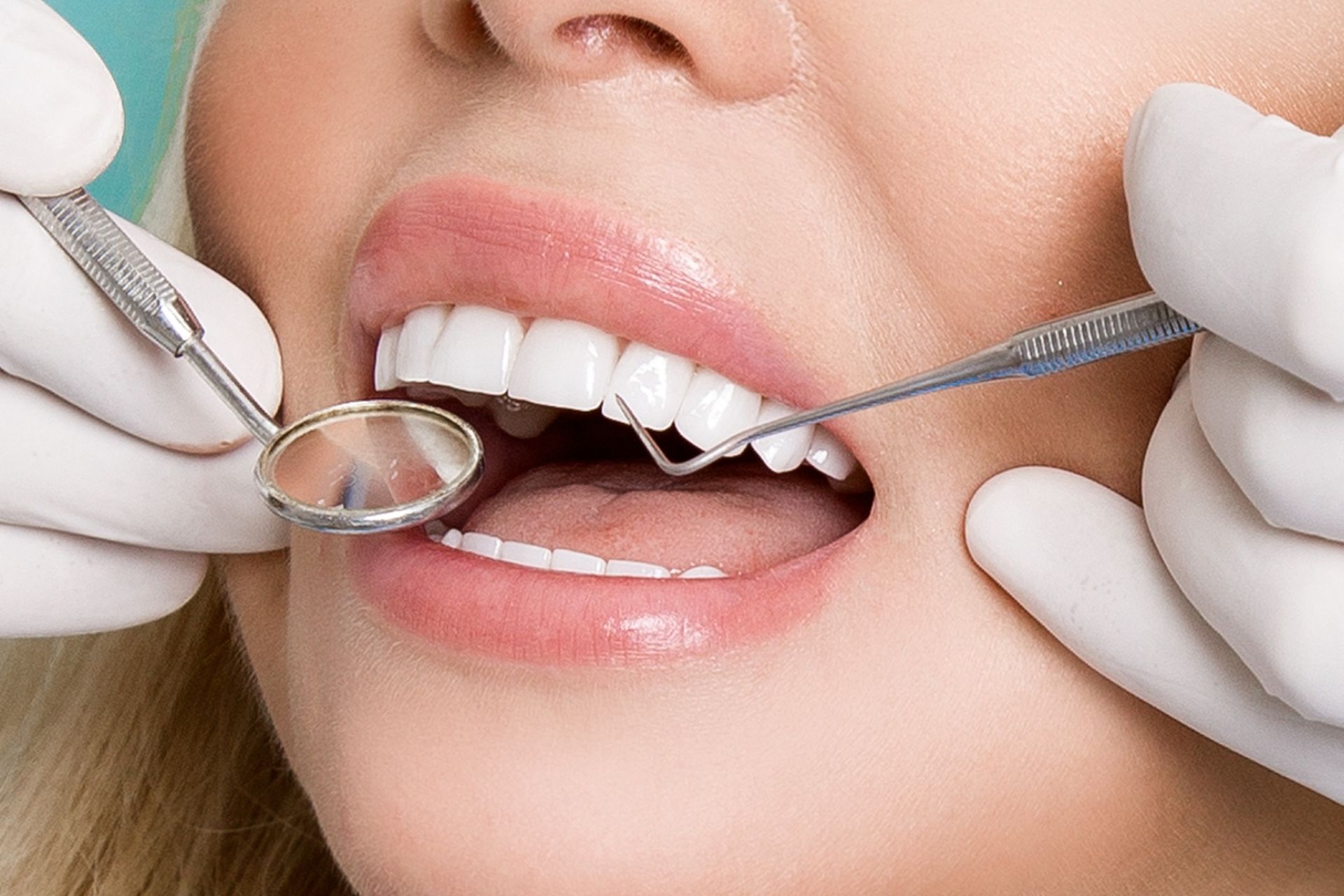 Una mujer está siendo examinada por un dentista.
