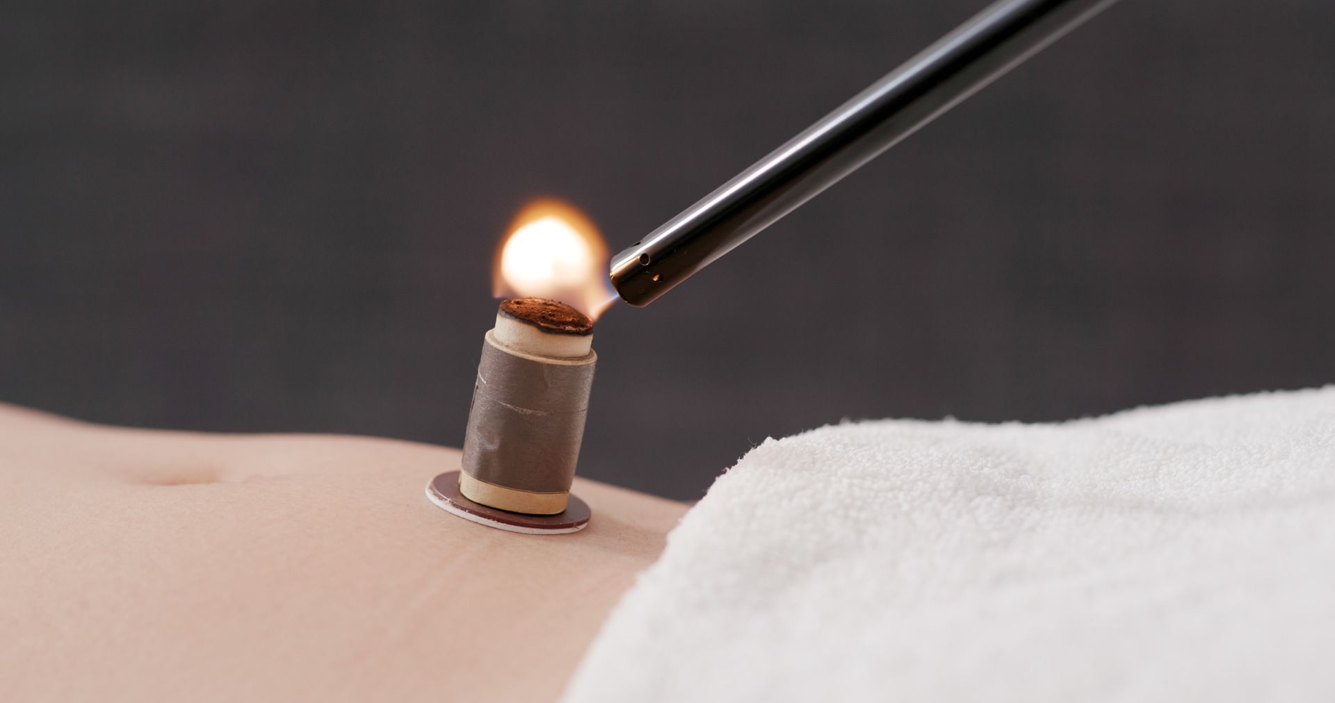 Kerze auf Rücken von Kunden der Praxis Traditionelle Chinesische Medizin Barbara Schatt