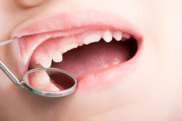 Un primer plano de una persona a la que un dentista le examina los dientes.