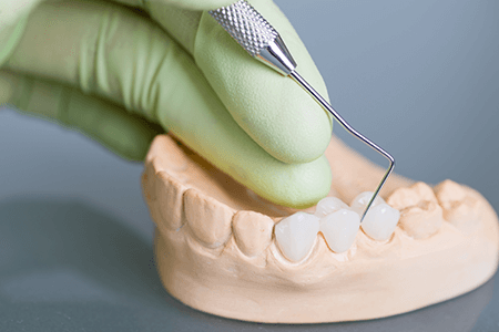 Un dentista está examinando un modelo de los dientes de una persona.