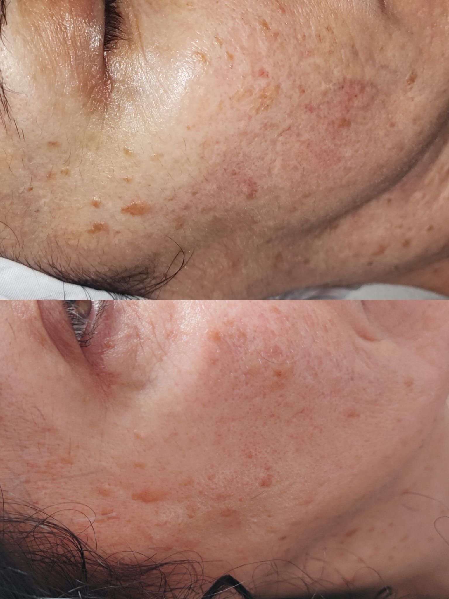 Una mujer está recibiendo un tratamiento facial en un spa.
