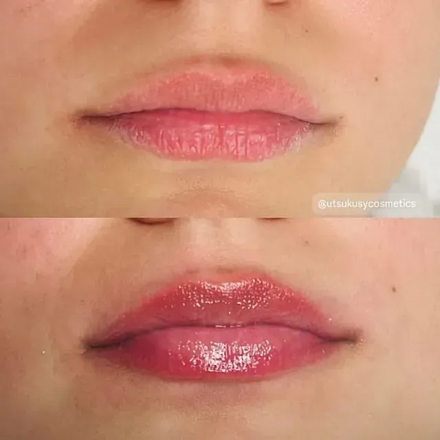 Una foto de antes y después de los labios de una mujer.