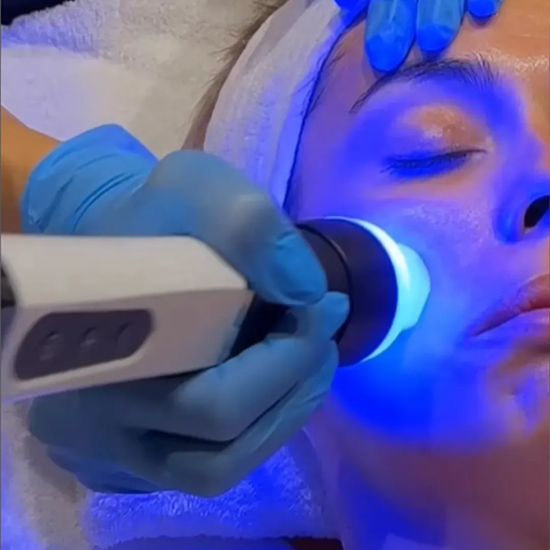 Mujer recibiendo tratamiento facial con un dispositivo de luz roja. Una persona con guantes sostiene el dispositivo.