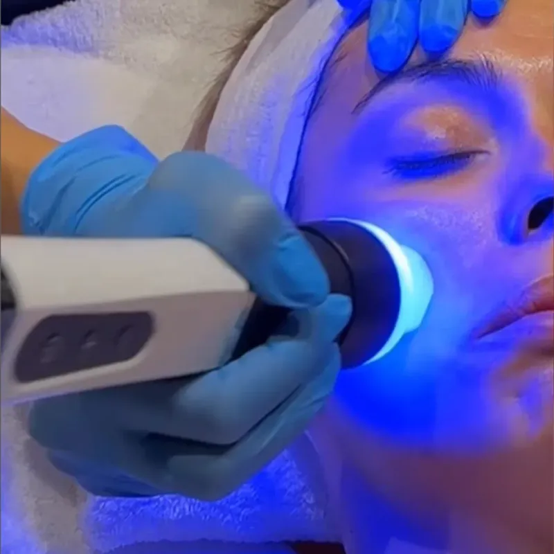 Mujer recibiendo tratamiento facial con un dispositivo de luz roja. Una persona con guantes sostiene el dispositivo.