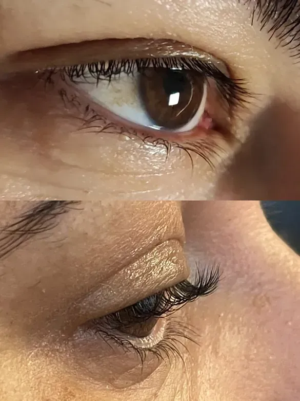 Un primer plano del ojo de una mujer antes y después de las extensiones de pestañas.