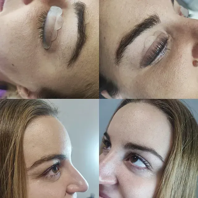 El rostro de una mujer se muestra en un collage de cuatro fotografías.