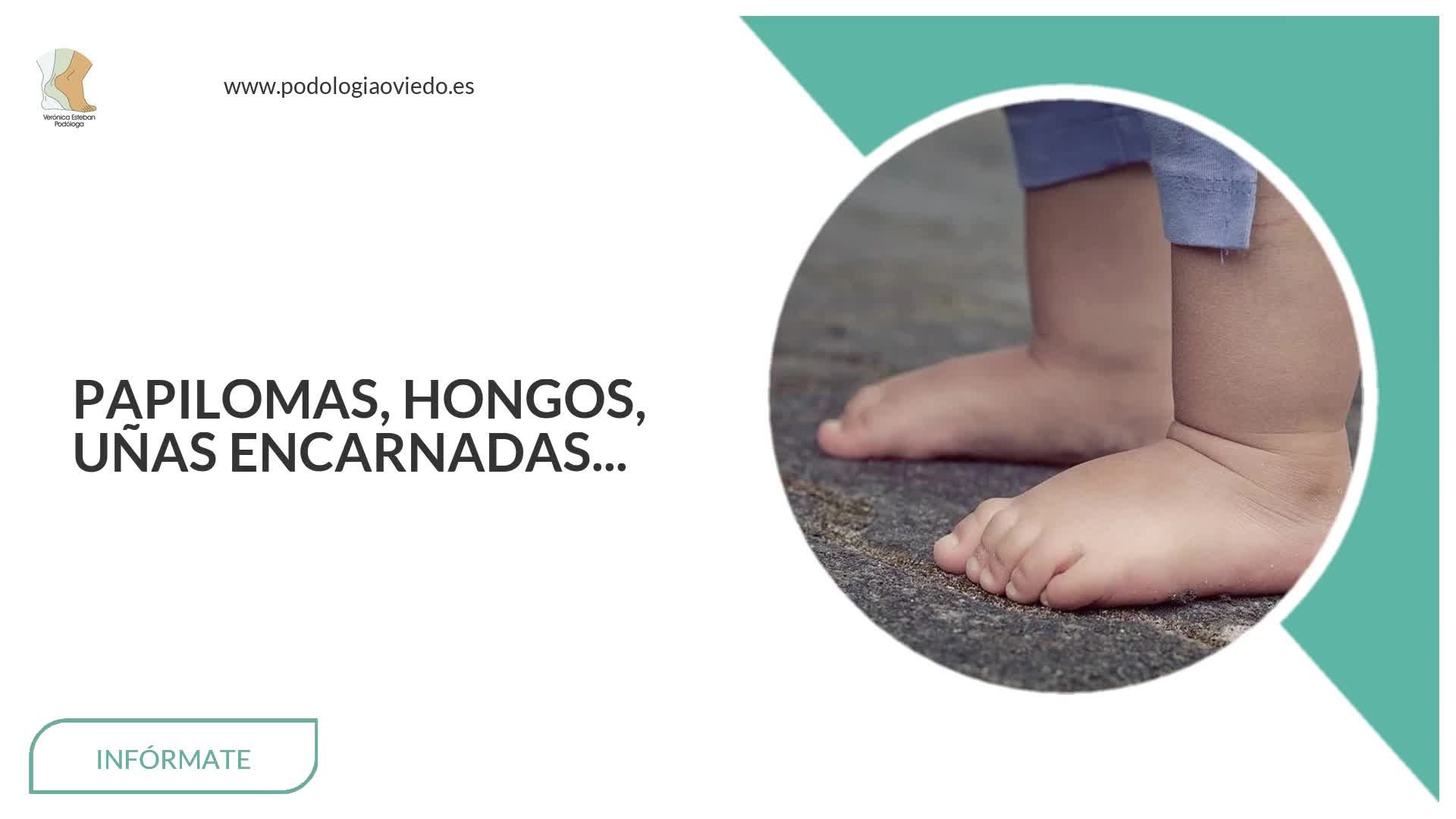 Podólogos en Oviedo | Verónica Esteban Mora