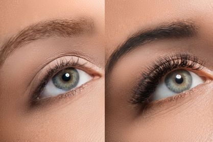 Una foto de antes y después de las cejas de una mujer.