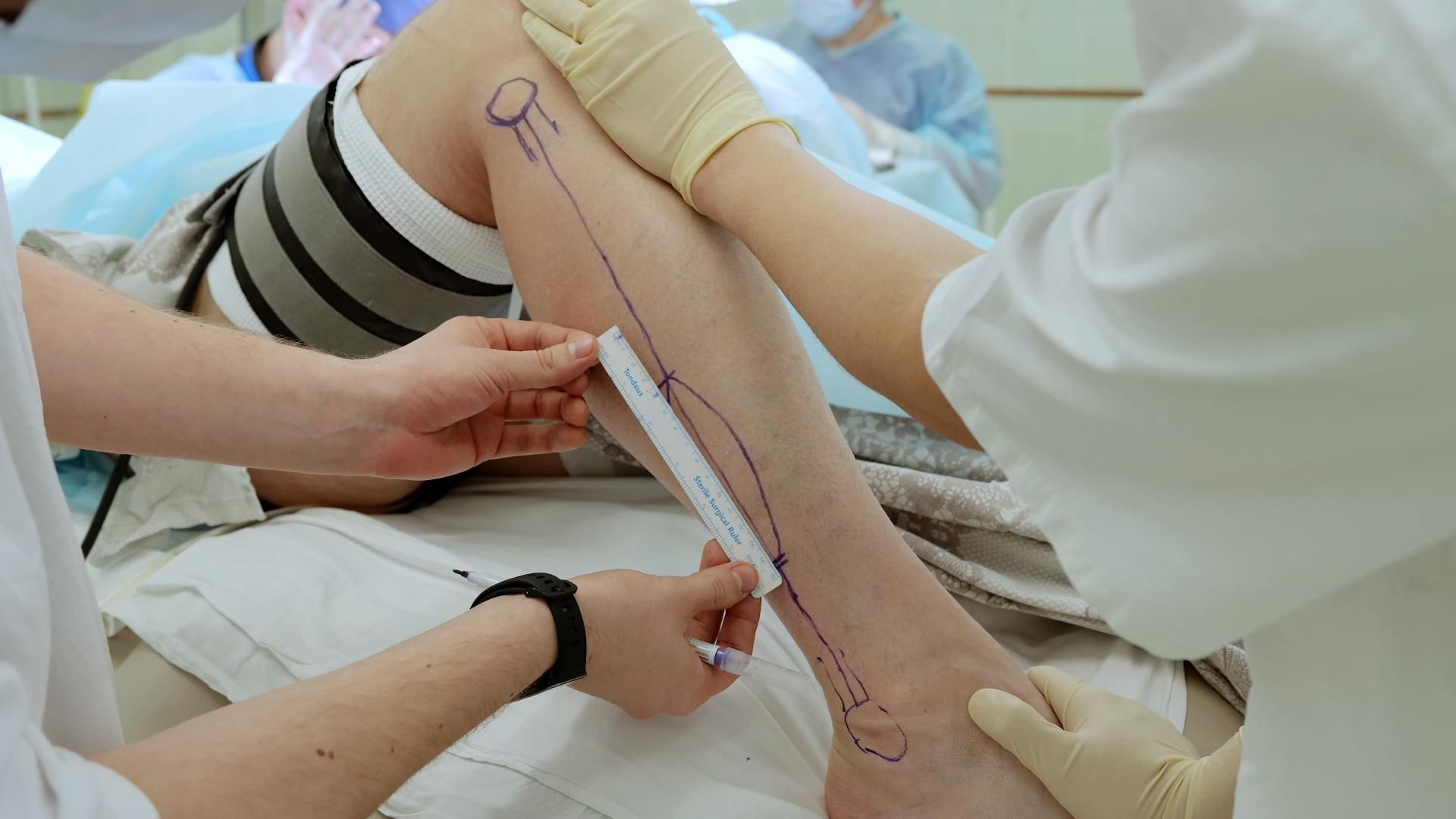 Medizinisches Personal markiert das Bein eines Patienten mit einem Stift in einer Krankenhausumgebung