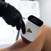 ein schwarzer Laserhaarentferner mit Rädern auf weißem Hintergrund .