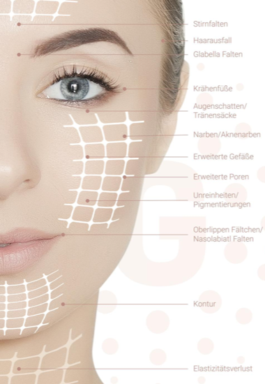 eine Frau mit blauen Augen steht auf einem Poster mit der Aufschrift meso-needling