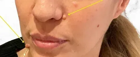 Un primer plano del rostro de una mujer con una flecha amarilla apuntando a su nariz.
