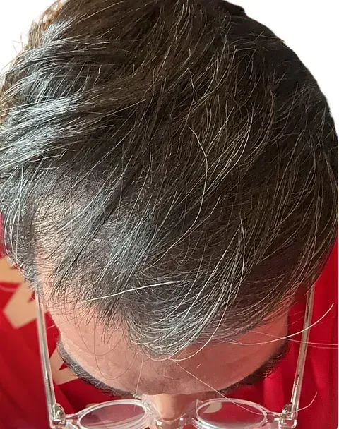 Un hombre que lleva gafas mira hacia su cabello.