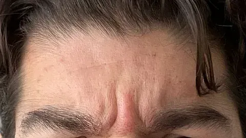 Un primer plano de la frente de un hombre con arrugas.