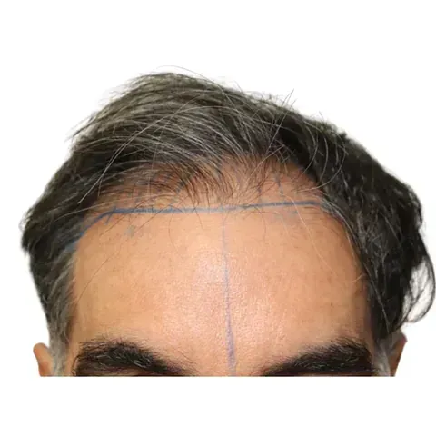 Un hombre con cabello gris tiene una línea azul dibujada en la frente.