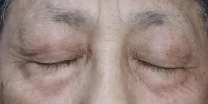 Un primer plano del rostro de una anciana con los ojos cerrados.