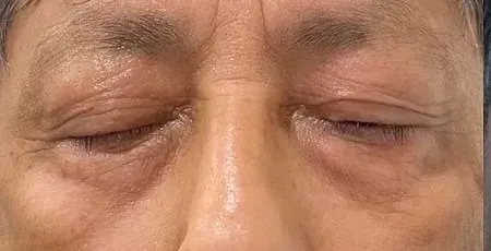Un primer plano del rostro de una anciana con los ojos cerrados.