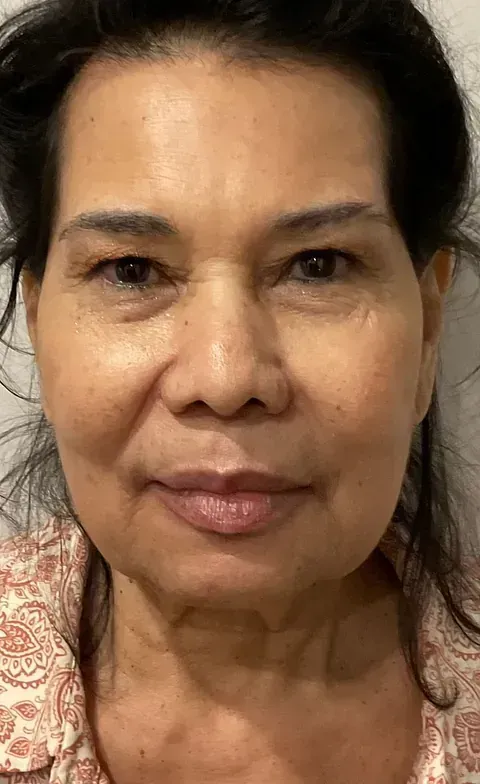 Un primer plano del rostro de una mujer sin maquillaje.