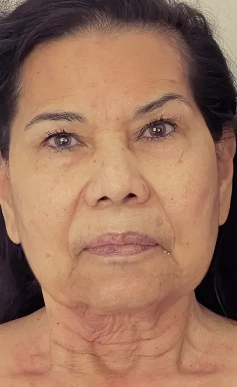 Un primer plano del rostro de una mujer sin maquillaje.