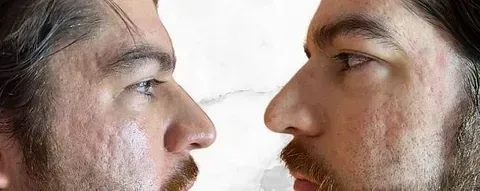 Un hombre con barba mira su reflejo en un espejo.
