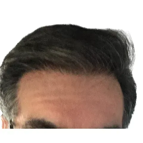 Un primer plano de la cabeza de un hombre con un fondo blanco.