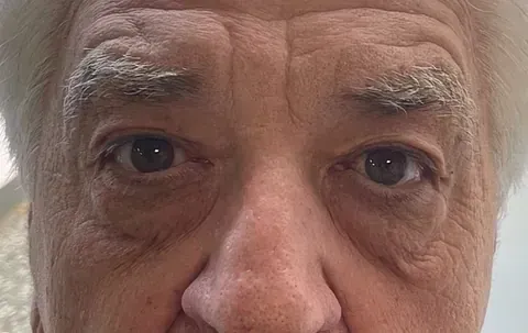Un primer plano de los ojos y la nariz de un hombre mayor.