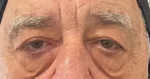 Un primer plano de los ojos y la nariz de un anciano.