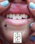 Piercing bouche Smiley - piercing dans la bouche