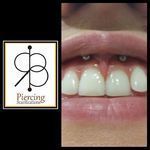 Piercing bouche Smiley - sous la lèvre inférieure