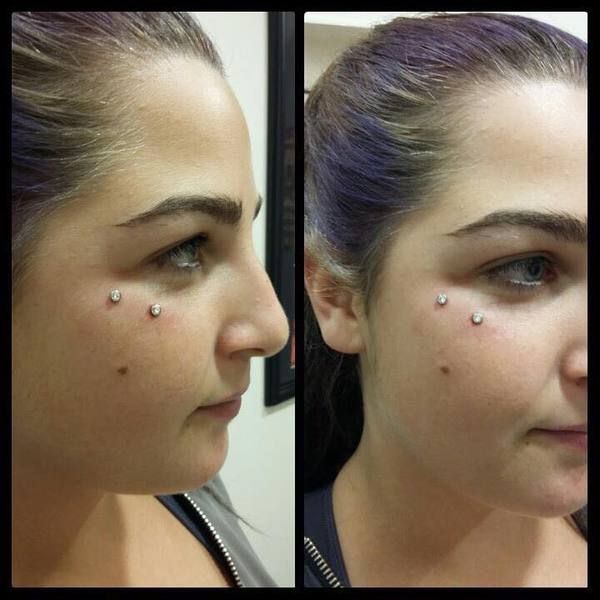 Piercing surface - sous l'œil