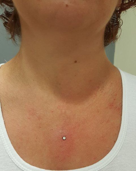 Piercing microdermal - au centre de la poitrine