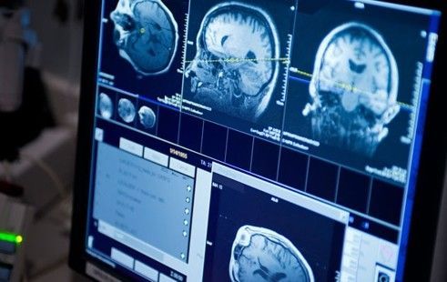 © Mayo Foundation for Medical Education and Research (MFMER). All rights reserved.