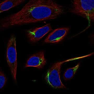 © Human Protein Atlas; available from: Subcellular - GFAP - The Human Protein Atlas
Das Projekt „Human Protein Atlas“ wird von der Knut- und Alice-Wallenberg-Stiftung finanziert