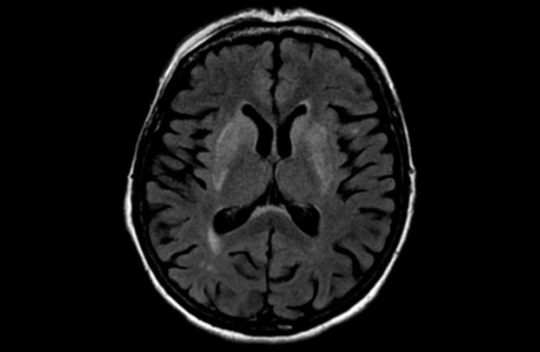 © Mayo Foundation for Medical Education and Research (MFMER). All rights reserved.