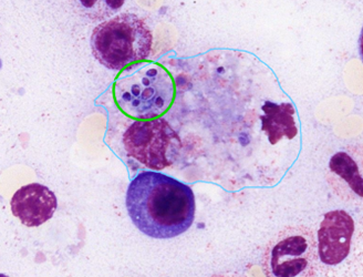 © eLCH Curriculum Hämatologie DGHO